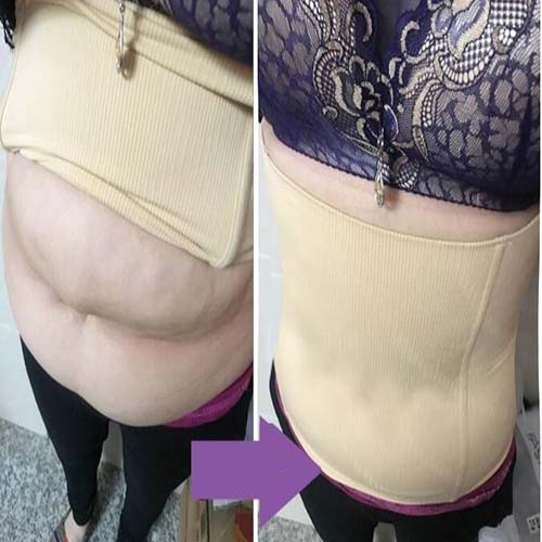 P530 High Compression Seamless Hip Women Body Shaper Before After Results